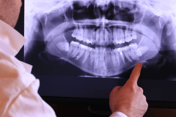 Best Emergency Tooth Extraction in Bay City, TX